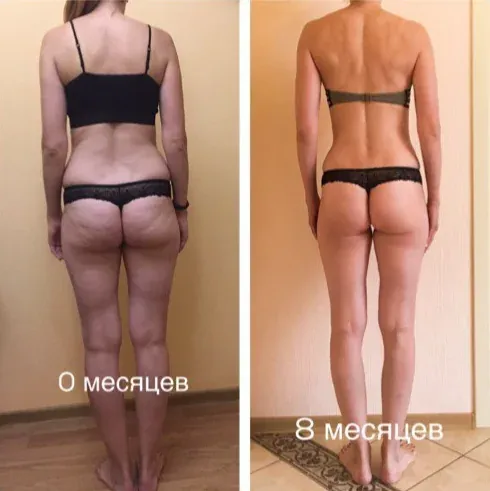 Татьяна: до и после
